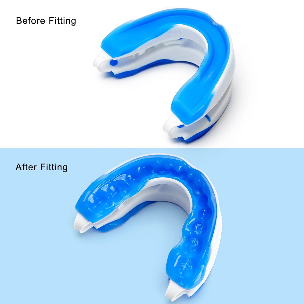Silicone Anti-Snore Mouth Guard