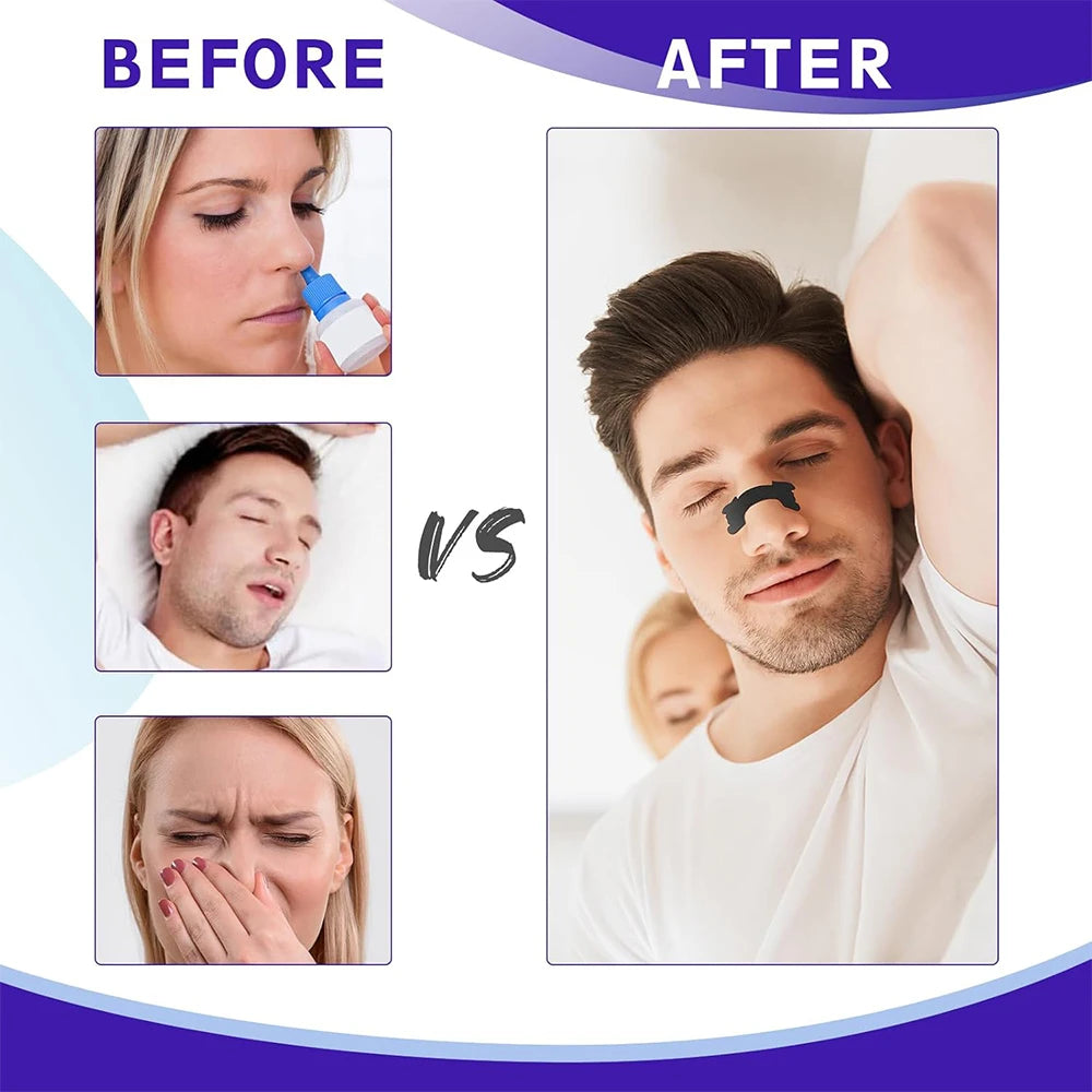 Black Nasal Strips for Better Breathing and Anti-Snoring