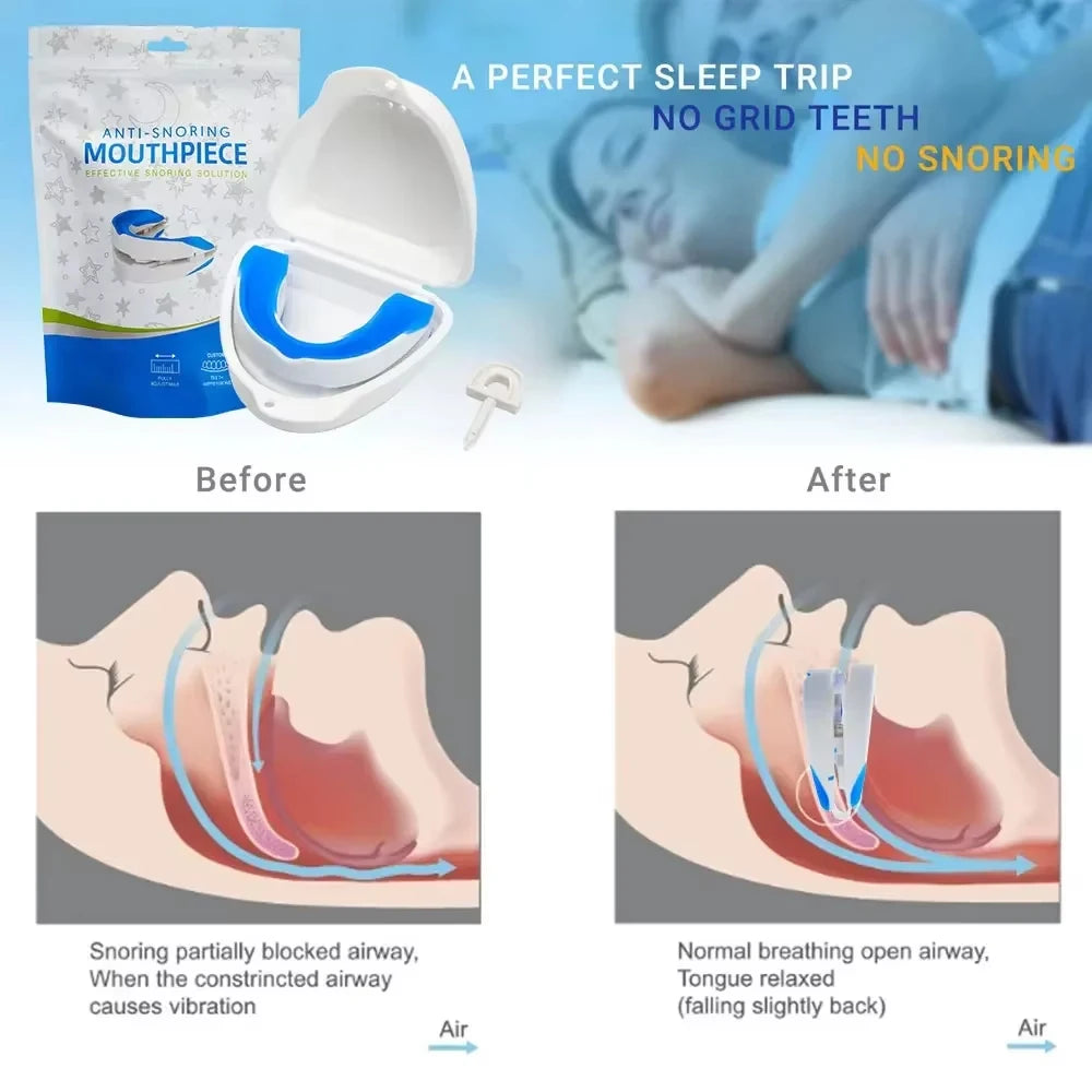 Silicone Anti-Snore Mouth Guard