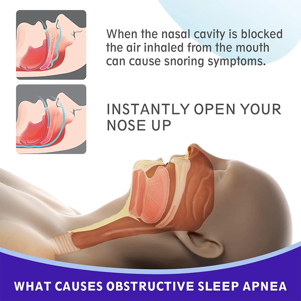 Black Nasal Strips for Better Breathing and Anti-Snoring