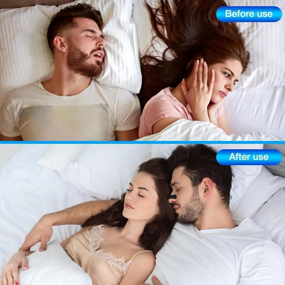 Anti Snoring Nose Strips – Breathable Nasal Patch for Better Sleep & Breathing Correction
