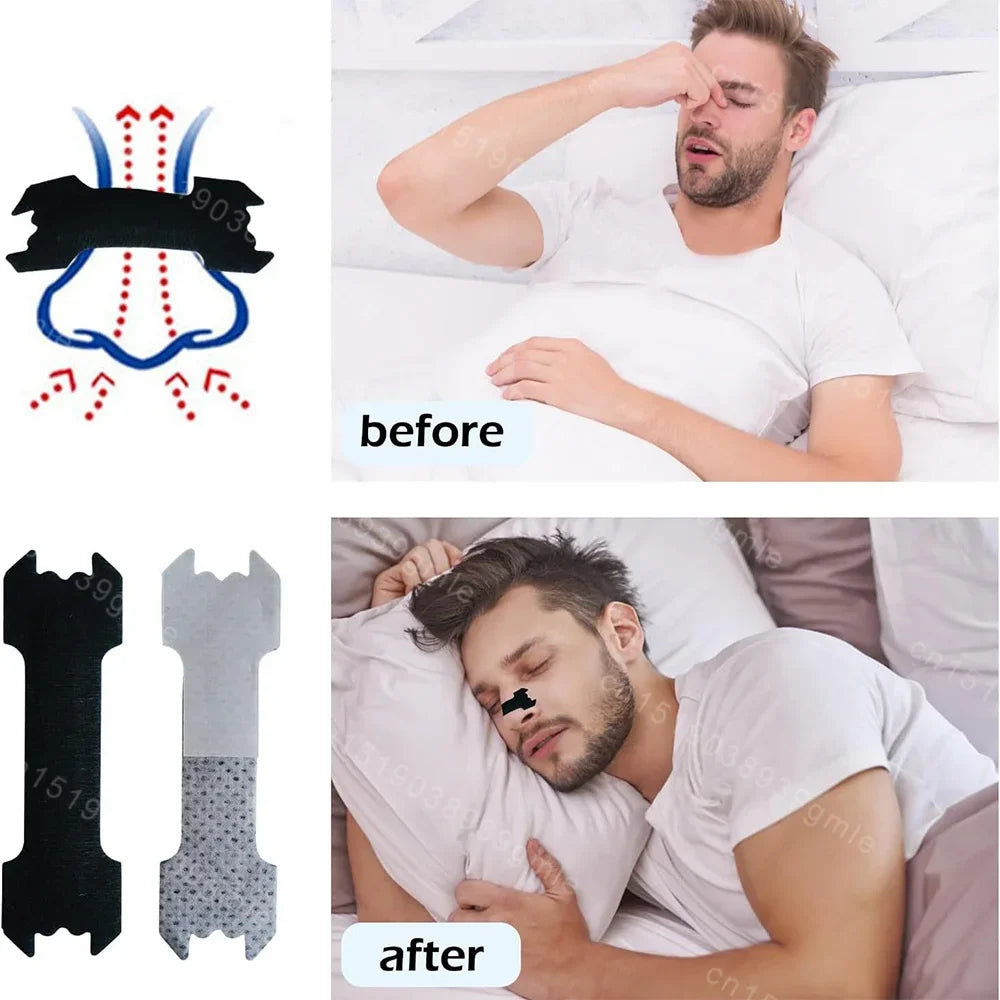 Anti-Snoring Nasal Strips for Better Breathing